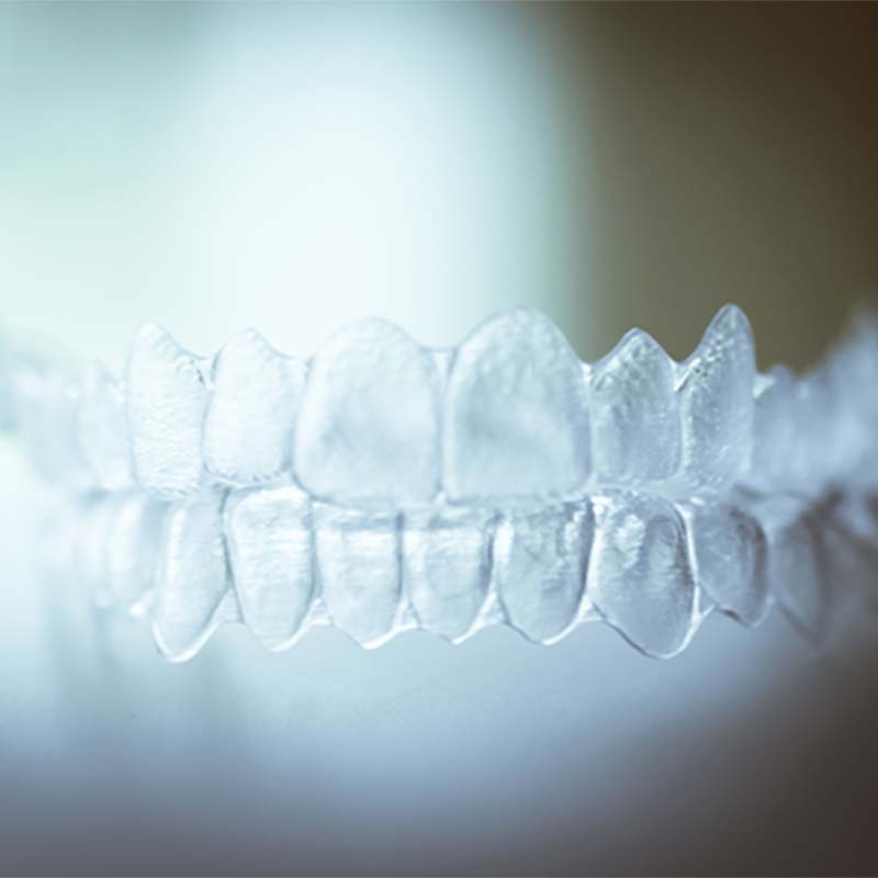 各種マウスピース製作